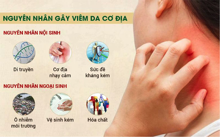 Viêm Da Cơ Địa Nguyên Nhân: Tìm Hiểu Nguyên Nhân Và Cách Phòng Tránh